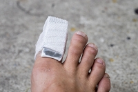 Signs of a Broken Toe