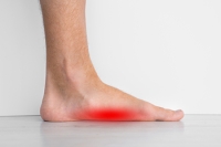 How Are Flat Feet Diagnosed?