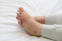 Causes and Relief Strategies for Swollen Feet